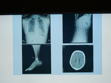 Film Pencitraan Medis Konida X Ray Tahan Air Untuk Printer Agfa