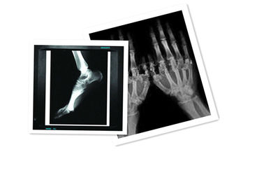 Hosipital PET Film Medis X Ray Kertas Waterproof 8 × 10 Inch CT Film Putih