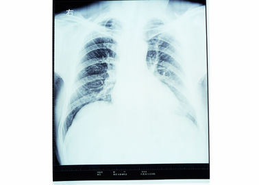 Radiologi Pencitraan Diagnostik Medis Dry X Ray Untuk AGFA / FUJI 2000