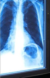 Blue Medical Dry Imaging Film, Laser Fuji X Ray 11in x 14in