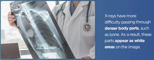 Latest company news about Bagaimana Sinar-X Diproduksi?