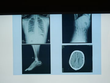 Good price Film Pencitraan Medis Konida X Ray Tahan Air Untuk Printer Agfa on line