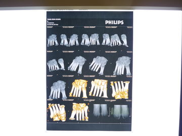 Good price Diagnostik AGFA Digital X Ray Film Tahan Air Dengan Nada Cerah on line