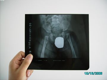 Good price Perak Halide Laser X-Ray Pencitraan Medis Tahan Air Tipis Agfa DRYSTAR DT1B / DT2B on line