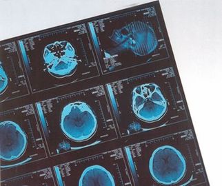 Good price Film Digital Medis X Ray Dry Thermal Untuk Rumah Sakit CR / DR on line