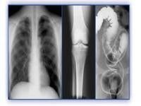 Good price Film Pencitraan Medis Holografik, Printer Thermal Film PET X Ray on line