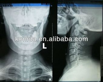 Good price Pencitraan Diagnostik Medis Ketajaman Tinggi, Film AGFA X Ray Kering on line