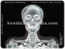 Good price Film printer termal sinar-X medis KND-F25*30cm on line