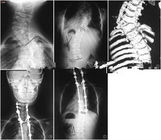 Cakupan Tinta Cakupan Tinggi X-ray Pencitraan Diagnostik, Film Medis x-ray 35 x 43cm