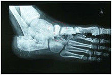 Good price 13in x 17in Degradable X Ray Pencitraan Diagnostik Kertas Medis Untuk Printer Laser on line