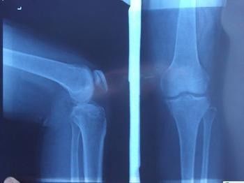 Good price Pencitraan Diagnostik Blue X Ray, Film Laser Medis Kertas Xray on line