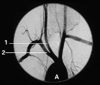 Good price Konida Medical X Ray Films on line