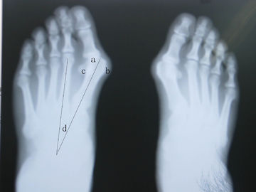 Good price Pencitraan Diagnostik Waterproof X Ray on line