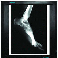 Good price 20cm x 25cm Pencitraan Diagnostik Medis, Film Laser Printer Kertas X Ray on line