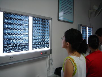Good price 10in X 12in X Ray Film Kering on line