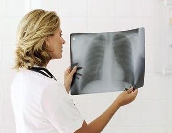 Good price Pencitraan Diagnostik Sinar X 20cm X 25cm on line