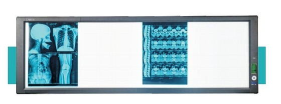 Good price Kotak penampil super terang LED medis on line