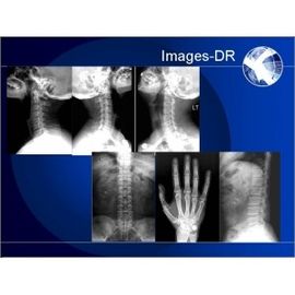 Good price Mesin Radiografi Digital Mammogrpahy X-RAY Dengan Lengan UC Fleksibel on line