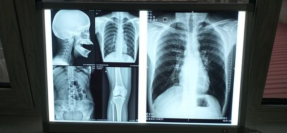 Harga bagus Silk Screen Medical Inkjet Film Permukaan Mengkilap Tahan Air on line