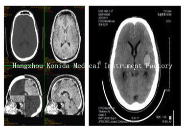 Good price Film Printer Thermal Kabut Rendah Fuji Drypix Medical Clear Image Dengan Nada Cerah on line