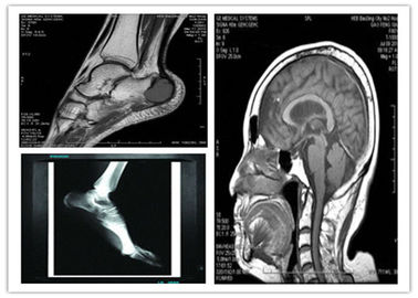 Good price Medical Digital Blue Base Dry Imaging Film 8 x 10in Pemindaian Hosipital Mri yang Kompatibel on line