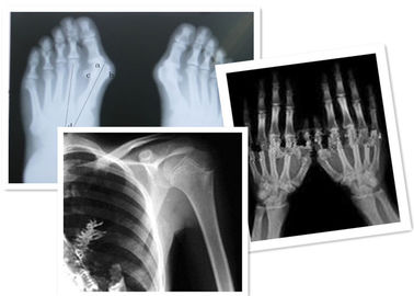 Good price Thermal Digital X Ray Film Fuji Medical Untuk Pemeriksaan Radiografi on line