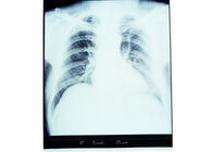 10 x 14 X-ray Medical Dry Imaging Film Sensitif Thermal Untuk Printer Fuji