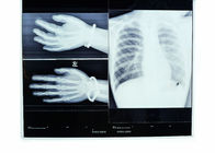 Konida Medical X Ray Dry Film Thermal Untuk AGFA 5300 / Fuji 3000