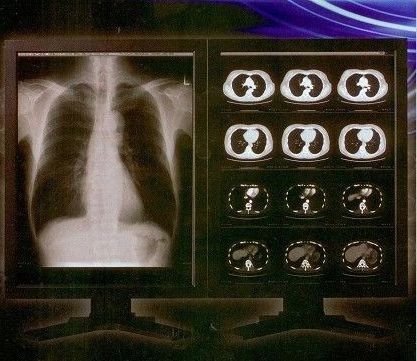 Film Digital X Ray Terang Jelas, Konida Medical Laser Transparency Film