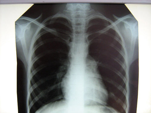 Rumah Sakit Bersihkan Medis X-Ray Film Konida Dengan Printer Thermal