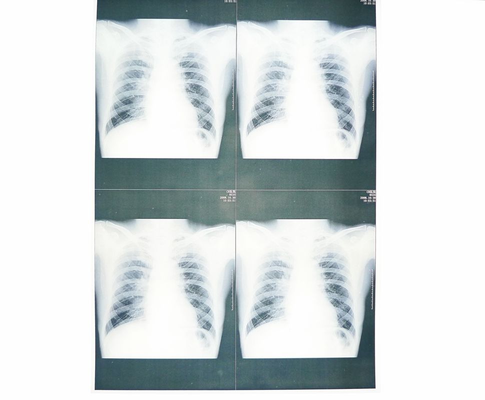 White Base Medical X Ray Paper Film Moistureproof Untuk Sony / EPSON Laser Printer
