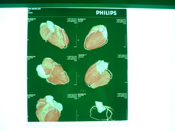 Good price Film Kering Medis Digital X Ray, Dt2b / Dt1b Agfa Medical Dry Imaging Film on line