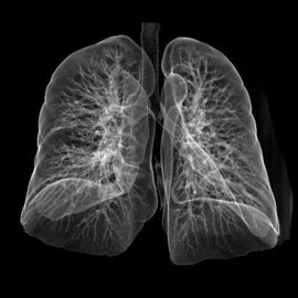 Good price Konida Tinggi Medis X-Ray Film Laser Konida Untuk CT / DR on line