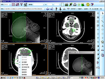 Good price 8 x 10 inci Kertas Medis Laser X Ray Pencitraan Diagnostik Untuk KND-DRYTEC 4000 on line