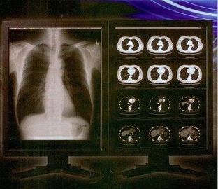 Good price Film Digital X Ray Terang Jelas, Konida Medical Laser Transparency Film on line