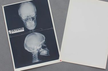Good price Putih Kertas Medis Dada X Ray Film Tahan Air Ketajaman Tinggi on line