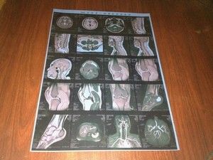 Good price Film Sinar X Medis Kabut Rendah, Ketajaman Tinggi Konida X-ray Dry Film on line