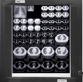 Film X-Ray Medis Basis Putih yang Dapat Dipakai, Film Kertas Pencitraan Medis Sinar-X