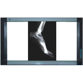 Film Pencitraan Medis Holografik, Printer Thermal Film PET X Ray