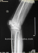 Good price Pencitraan Diagnostik Sinar X yang Tahan Lama, 32 cm x 43 cm Kertas Medis Laser Blue X Ray Film on line