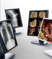 Good price Gambar yang jelas Menampilkan Kelas Medis, Tampilan Medis Skala Abu-abu 5MP on line