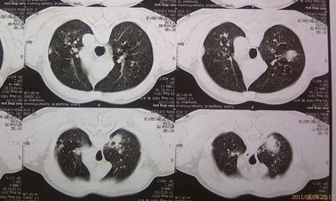 Good price Film Kering Medis Ramah Lingkungan Agfa 2B X Ray Dengan Mesin CT on line