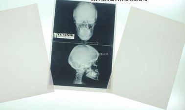 Good price Degradable White Base Xray Paper, Film Medis Untuk Printer Laser on line