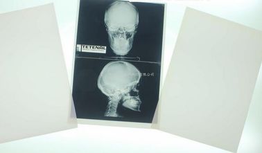 Good price 11 x 14 Pencitraan Diagnostik Medis Laser Untuk Printer Laser Konida on line