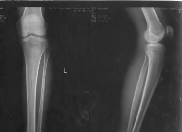 Good price 32cm * 43cm Xray Kertas Medis Laser Pencitraan Film Untuk KND-DRYTEC-4000 KND-K on line