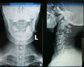 Good price Ketajaman Tinggi Dpt Dipakai Konida Medical Pencitraan Xray Kertas Untuk Printer Laser on line