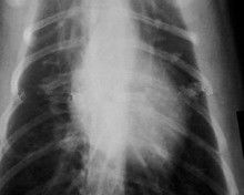 Good price Kabut Rendah 11 x 14 Kertas Xray Film Untuk Printer Laser Medis KND-K on line