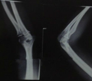 Good price Kertas Medis Pencitraan Diagnostik Tahan Air X Ray Untuk Printer Laser KND-K on line