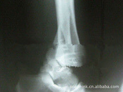 Good price White Paper Laser X Ray Imaging Medis 8in x 10in Tahan Air on line