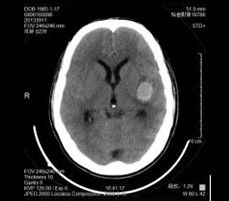 Good price Film X-Ray Medis Resolusi Tinggi Tahan Panas 35 x 43cm on line
